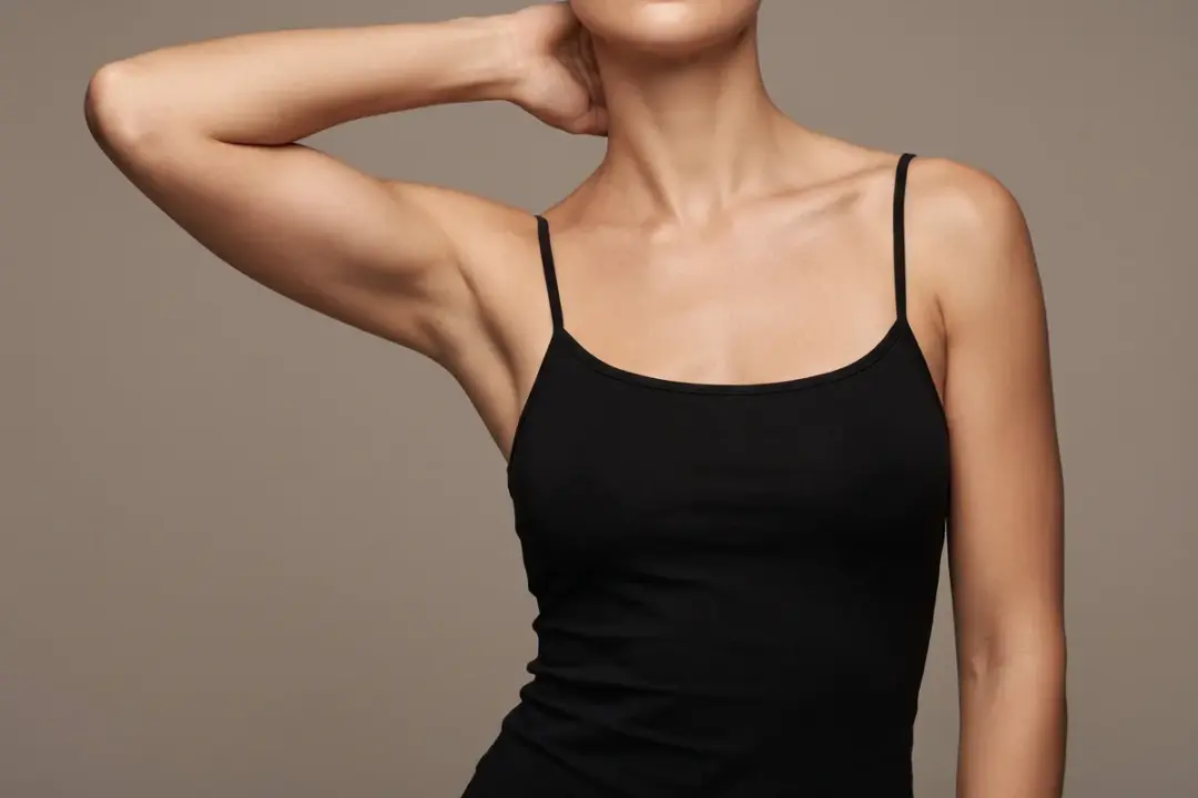 Woman in a black tank top with one arm raised behind her head — arm lift (brachioplasty) with Dr. Mehmet Sürmeli, Istanbul